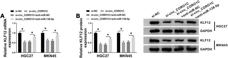 https://cdn.ncbi.nlm.nih.gov/pmc/blobs/1a1d/8123969/6e5399a1ffd7/CMAR-13-3789-g0007.jpg
