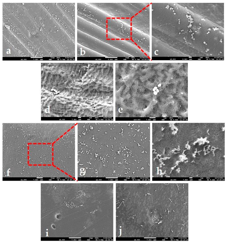 https://cdn.ncbi.nlm.nih.gov/pmc/blobs/1a1d/8949314/6fbca0e80297/ijms-23-02983-g007.jpg