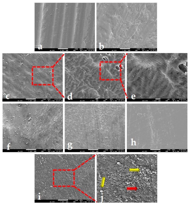 https://cdn.ncbi.nlm.nih.gov/pmc/blobs/1a1d/8949314/81585dae84b2/ijms-23-02983-g004.jpg