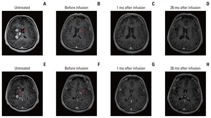 https://cdn.ncbi.nlm.nih.gov/pmc/blobs/1a29/10582536/4c3734bfc69f/crt-2023-371f1.jpg