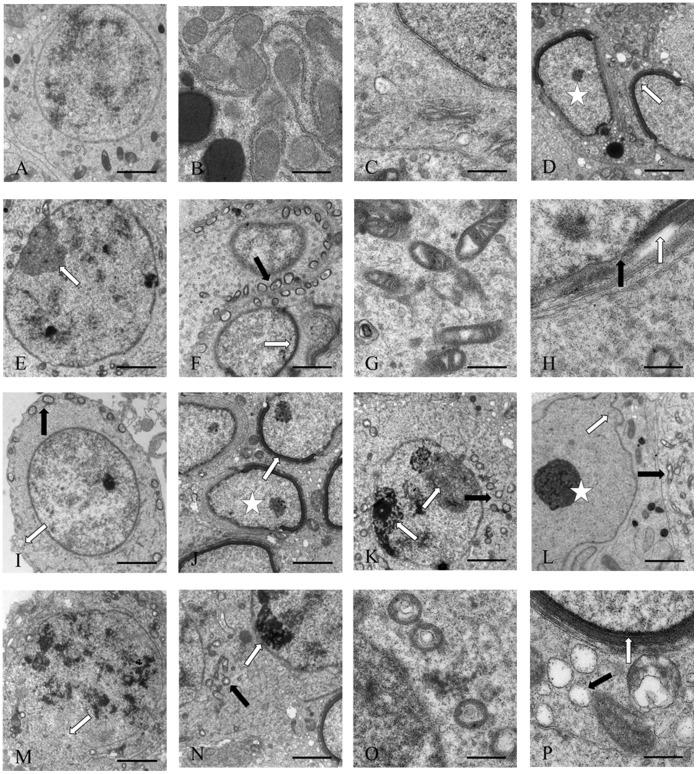 https://cdn.ncbi.nlm.nih.gov/pmc/blobs/1a2a/3547071/1bc5cf49f4b4/pone.0053949.g003.jpg