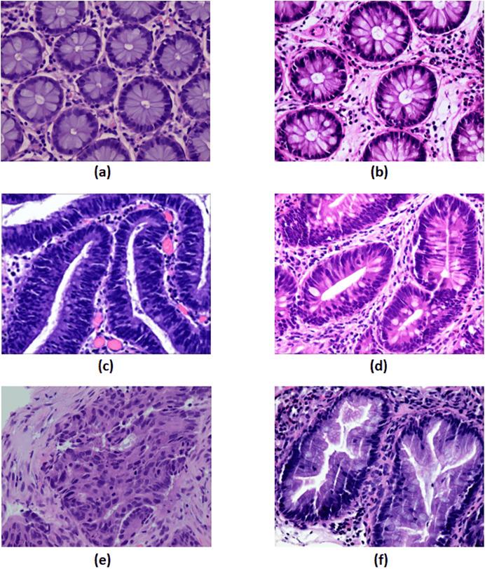 https://cdn.ncbi.nlm.nih.gov/pmc/blobs/1a2e/11157578/9ac7dab6301b/peerj-cs-10-2071-g005.jpg