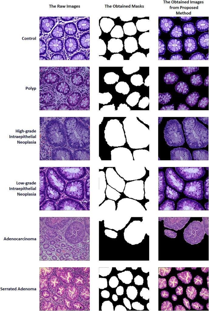 https://cdn.ncbi.nlm.nih.gov/pmc/blobs/1a2e/11157578/b9f31917e438/peerj-cs-10-2071-g002.jpg
