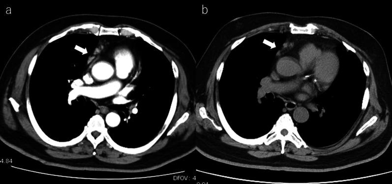 https://cdn.ncbi.nlm.nih.gov/pmc/blobs/1a3b/11564438/14e2c22160fe/40792_2024_2065_Fig1_HTML.jpg