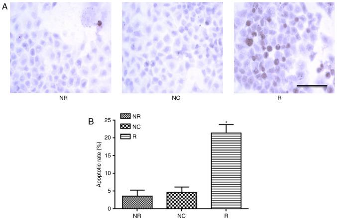 https://cdn.ncbi.nlm.nih.gov/pmc/blobs/1a3b/5802031/37847c141963/OR-39-03-1063-g06.jpg