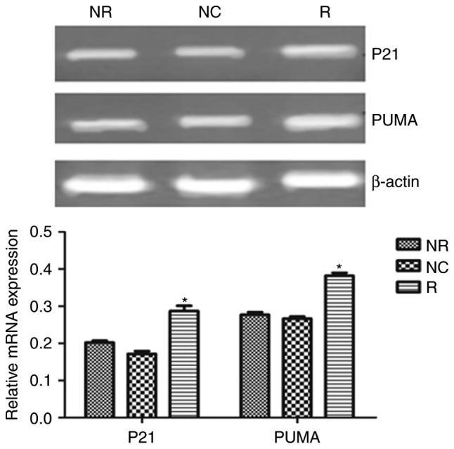 https://cdn.ncbi.nlm.nih.gov/pmc/blobs/1a3b/5802031/ce2ae227cfcc/OR-39-03-1063-g07.jpg