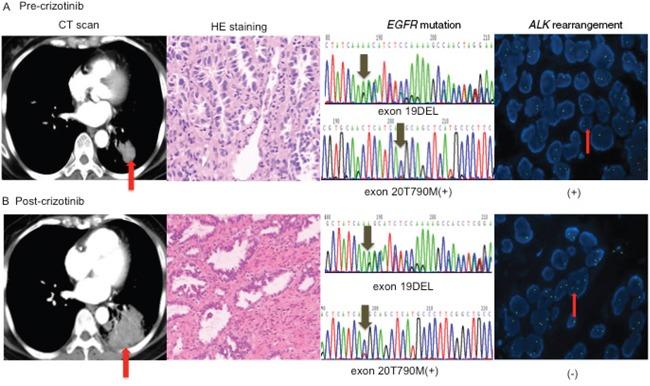 https://cdn.ncbi.nlm.nih.gov/pmc/blobs/1a3d/5323147/a7cc398eac07/oncotarget-07-65185-g003.jpg