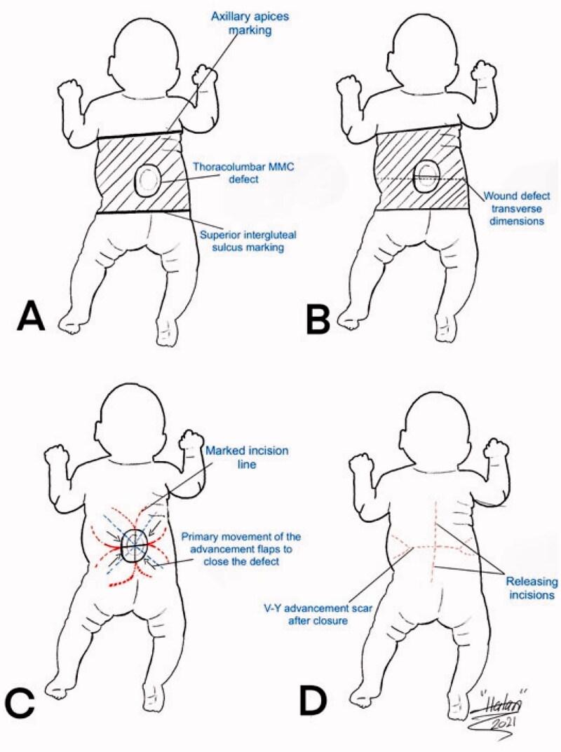 https://cdn.ncbi.nlm.nih.gov/pmc/blobs/1a3d/8409962/be0b573235d1/ICRP_A_1971528_F0003_C.jpg