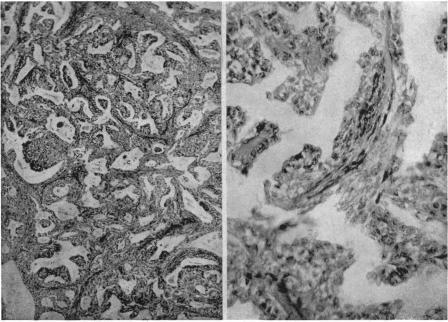 https://cdn.ncbi.nlm.nih.gov/pmc/blobs/1a49/1543944/d4da436898b2/annsurg01343-0101-a.jpg