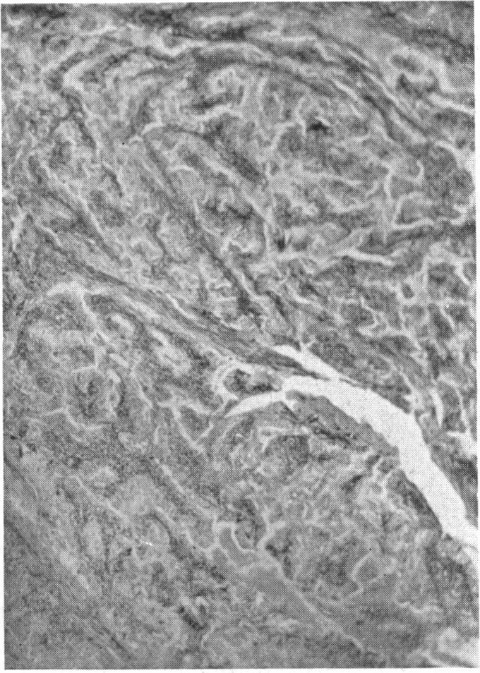 https://cdn.ncbi.nlm.nih.gov/pmc/blobs/1a49/1543944/dc81b43722c2/annsurg01343-0099-a.jpg