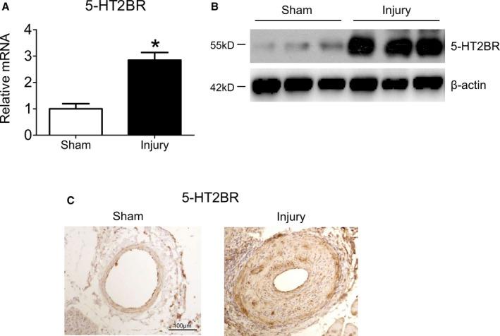 https://cdn.ncbi.nlm.nih.gov/pmc/blobs/1a49/5850233/f633b281d0aa/JAH3-7-e006810-g001.jpg