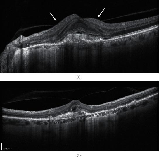 https://cdn.ncbi.nlm.nih.gov/pmc/blobs/1a4b/8313359/2e1e2b0a7943/joph2021-9994098.007.jpg