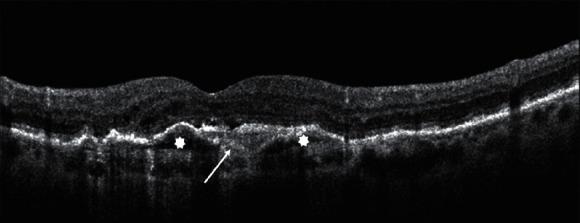 https://cdn.ncbi.nlm.nih.gov/pmc/blobs/1a4b/8313359/ae41d0bbcb0f/joph2021-9994098.005.jpg