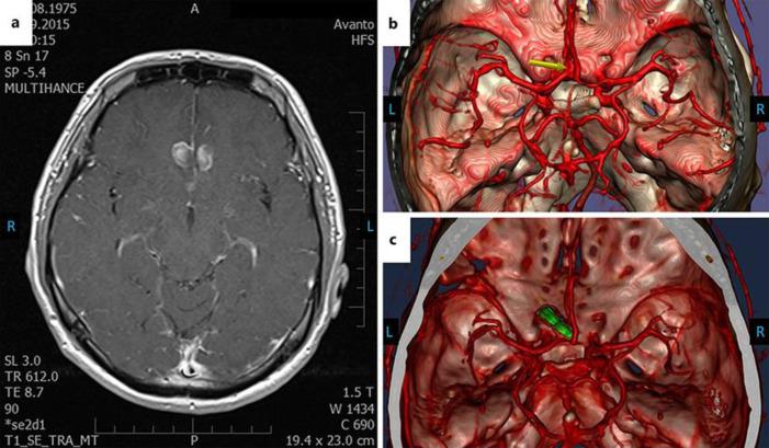 https://cdn.ncbi.nlm.nih.gov/pmc/blobs/1a58/8077657/80c111d38215/crn-0013-0218-g01.jpg