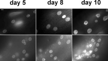 https://cdn.ncbi.nlm.nih.gov/pmc/blobs/1a5c/4496104/427397b76d35/jcmm0013-1059-f4.jpg