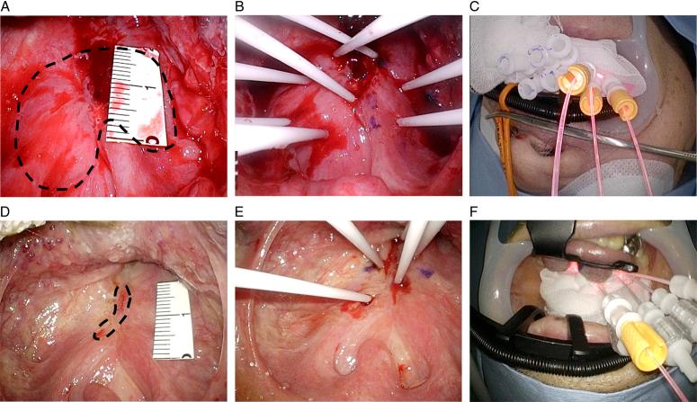 https://cdn.ncbi.nlm.nih.gov/pmc/blobs/1a5f/11374202/1efa7a529586/ms9-86-5551-g003.jpg