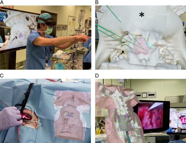 https://cdn.ncbi.nlm.nih.gov/pmc/blobs/1a5f/11374202/ac0ff9bf1714/ms9-86-5551-g002.jpg