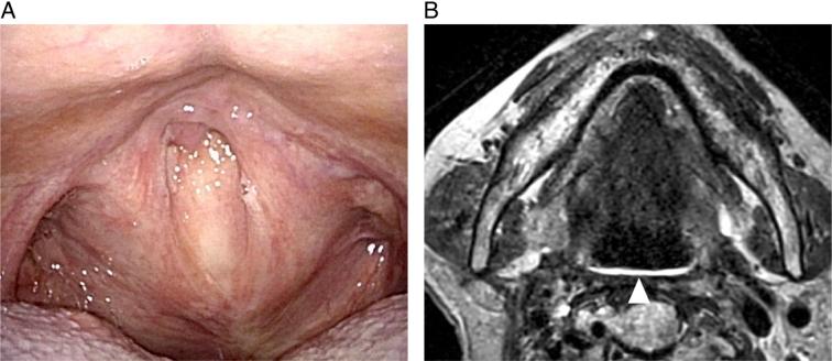 https://cdn.ncbi.nlm.nih.gov/pmc/blobs/1a5f/11374202/d7e063e0948e/ms9-86-5551-g004.jpg