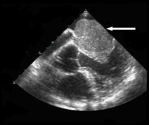 https://cdn.ncbi.nlm.nih.gov/pmc/blobs/1a61/2803851/45188670c4f5/1752-1947-3-9328-1.jpg