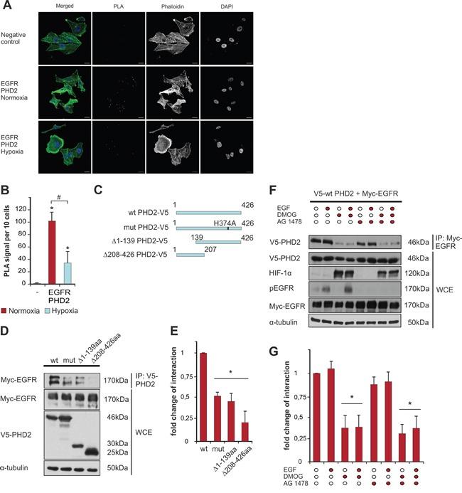 https://cdn.ncbi.nlm.nih.gov/pmc/blobs/1a63/5354778/c431f1350c3d/oncotarget-08-9885-g002.jpg