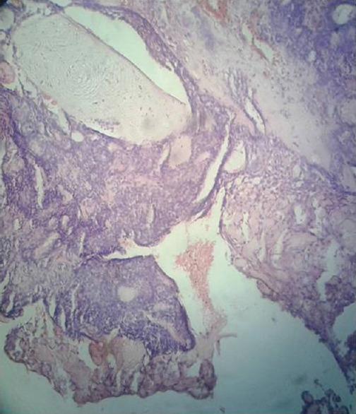 https://cdn.ncbi.nlm.nih.gov/pmc/blobs/1a73/10789463/5312dd519cb2/IJABMR-13-255-g006.jpg