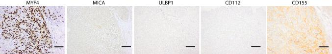 https://cdn.ncbi.nlm.nih.gov/pmc/blobs/1a7a/11029495/c31ea452c614/262_2015_1657_Fig2_HTML.jpg
