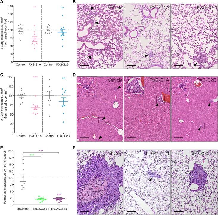 https://cdn.ncbi.nlm.nih.gov/pmc/blobs/1a82/5432238/225908f8481e/oncotarget-08-26066-g007.jpg