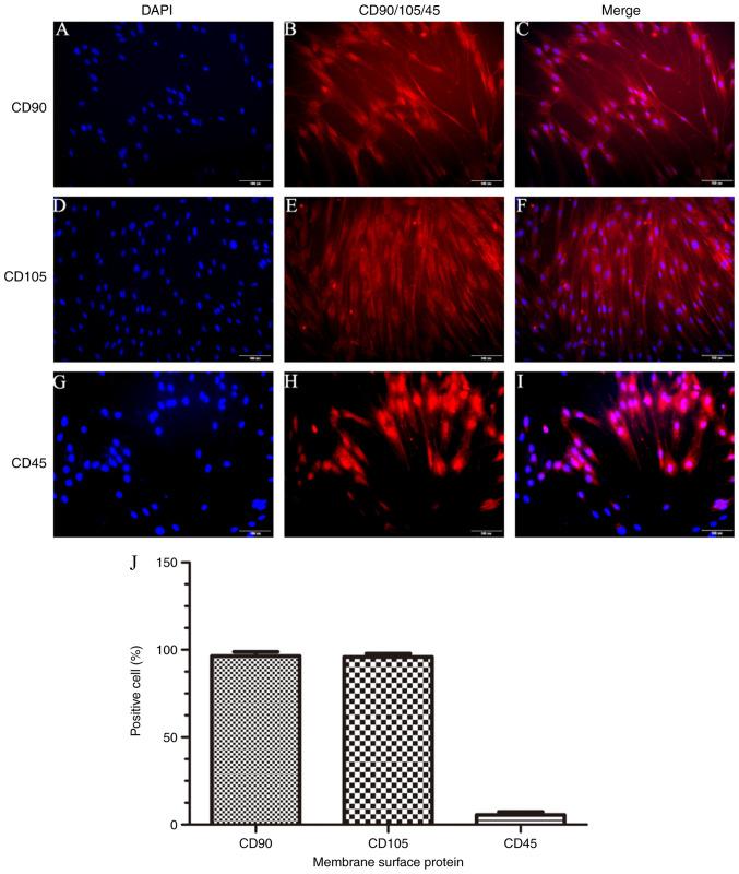 https://cdn.ncbi.nlm.nih.gov/pmc/blobs/1a82/7789091/2d3e6044a078/mmr-23-02-11801-g02.jpg