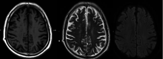 https://cdn.ncbi.nlm.nih.gov/pmc/blobs/1a8f/11549869/8b3c8e636c49/12883_2024_3909_Fig1_HTML.jpg