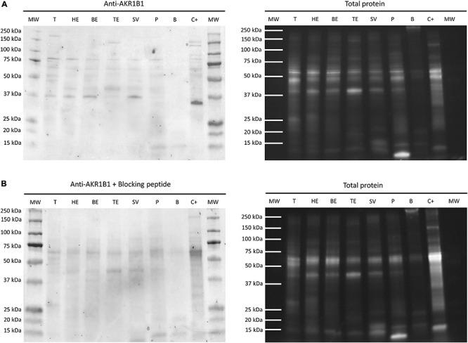https://cdn.ncbi.nlm.nih.gov/pmc/blobs/1a90/8217816/06efc1c67d92/fcell-09-683199-g002.jpg