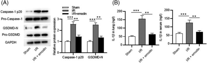 https://cdn.ncbi.nlm.nih.gov/pmc/blobs/1a9f/9978909/c264d4baf40b/CRJ-17-241-g002.jpg