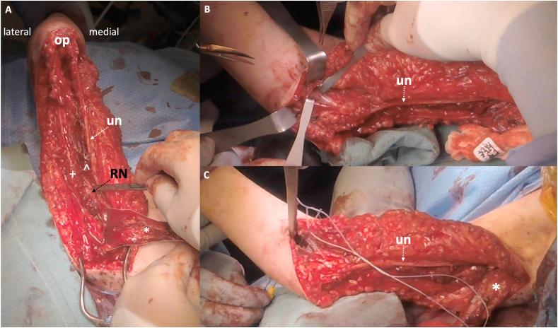 https://cdn.ncbi.nlm.nih.gov/pmc/blobs/1aaa/12310442/41a20b390aeb/gr5.jpg