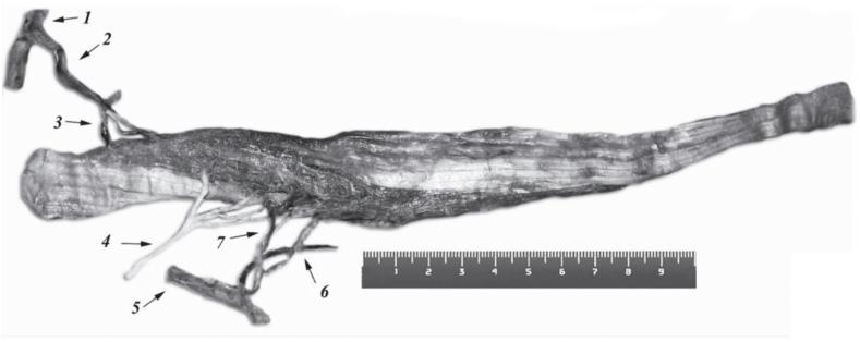 https://cdn.ncbi.nlm.nih.gov/pmc/blobs/1aaa/12310442/b8fd42d25a3f/gr1.jpg