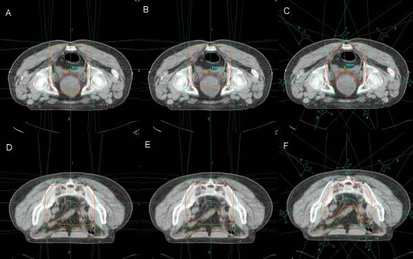 https://cdn.ncbi.nlm.nih.gov/pmc/blobs/1ab3/2845593/9a169e49e41b/1748-717X-5-17-2.jpg