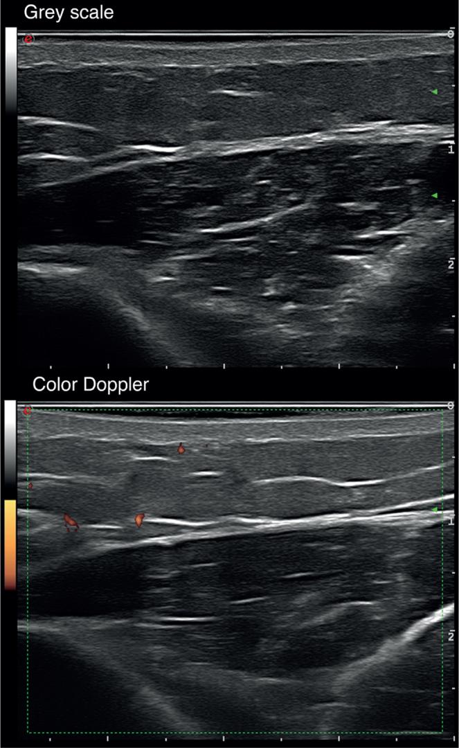 https://cdn.ncbi.nlm.nih.gov/pmc/blobs/1ac2/9366684/23670b8291f4/ActaDV-101-2-1042-g001.jpg
