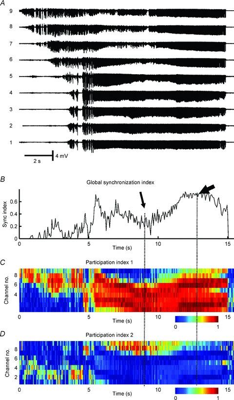 https://cdn.ncbi.nlm.nih.gov/pmc/blobs/1ac3/3591697/92d4a643284f/tjp0591-0787-f2.jpg
