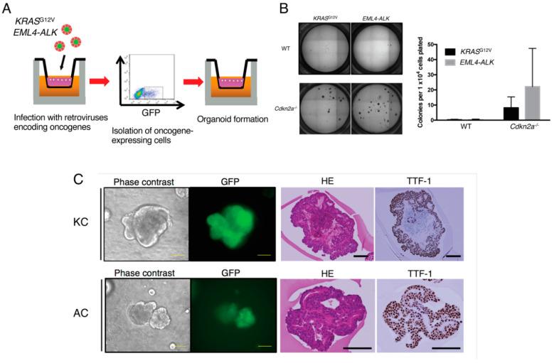 https://cdn.ncbi.nlm.nih.gov/pmc/blobs/1acd/7767274/d2b3f466043a/cancers-12-03805-g002.jpg