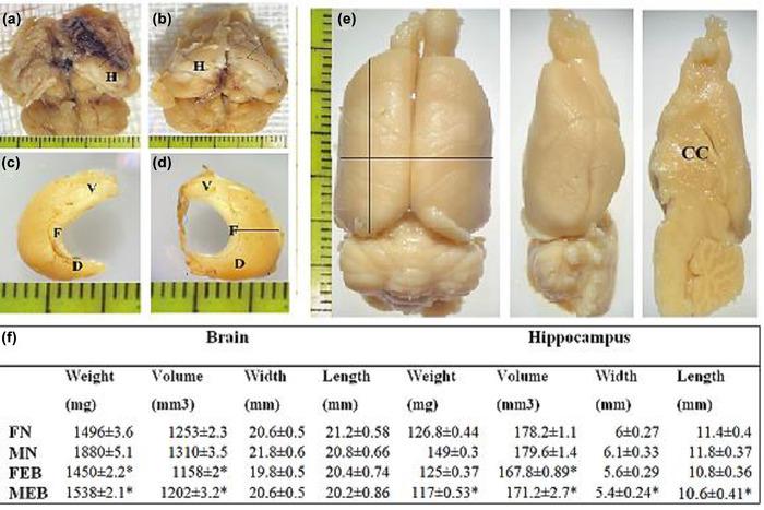 https://cdn.ncbi.nlm.nih.gov/pmc/blobs/1acd/9392515/7f5b8f261450/BRB3-12-e32723-g006.jpg
