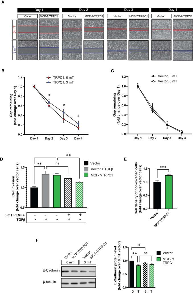 https://cdn.ncbi.nlm.nih.gov/pmc/blobs/1ace/8818958/8ea58324d20d/fonc-11-783803-g007.jpg