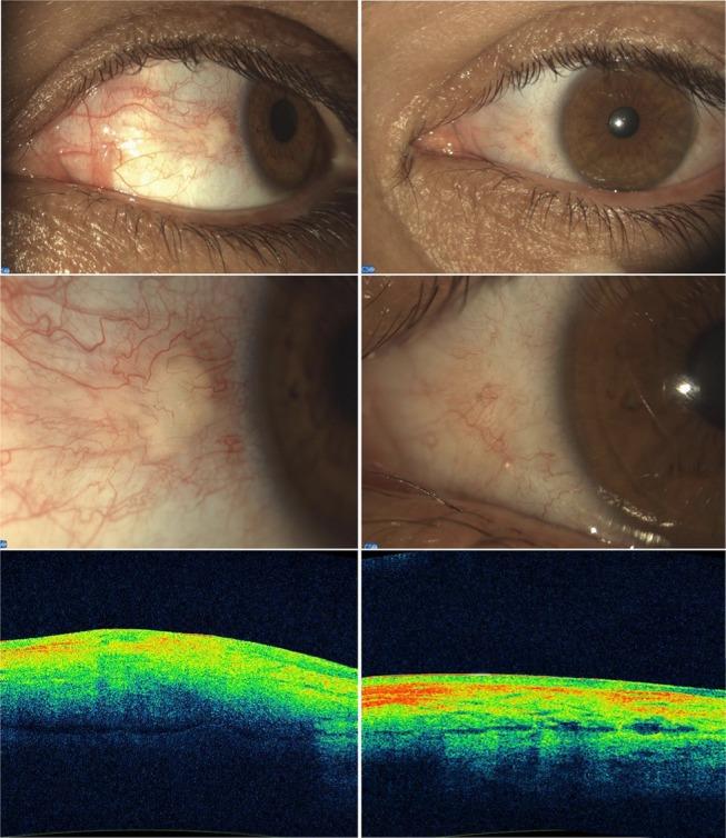 https://cdn.ncbi.nlm.nih.gov/pmc/blobs/1ad5/5533570/642313dc724e/imcrj-10-247Fig2.jpg