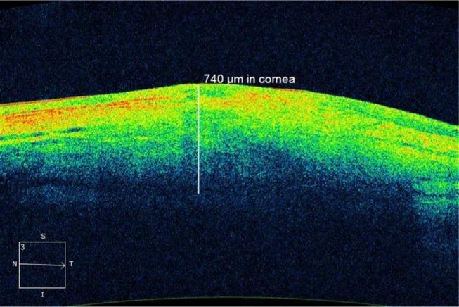 https://cdn.ncbi.nlm.nih.gov/pmc/blobs/1ad5/5533570/f6ee187fd55b/imcrj-10-247Fig1.jpg