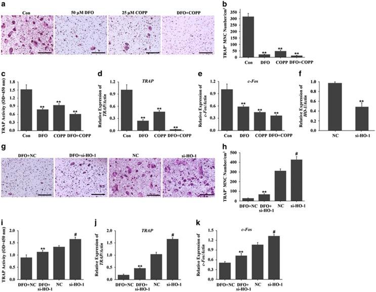 https://cdn.ncbi.nlm.nih.gov/pmc/blobs/1ae9/5133998/6915ee09002c/cddis2016339f7.jpg