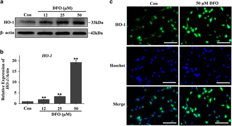 https://cdn.ncbi.nlm.nih.gov/pmc/blobs/1ae9/5133998/7b40253a66ad/cddis2016339f6.jpg