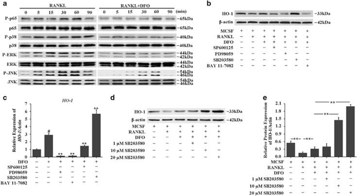 https://cdn.ncbi.nlm.nih.gov/pmc/blobs/1ae9/5133998/ba80b73c7f09/cddis2016339f8.jpg