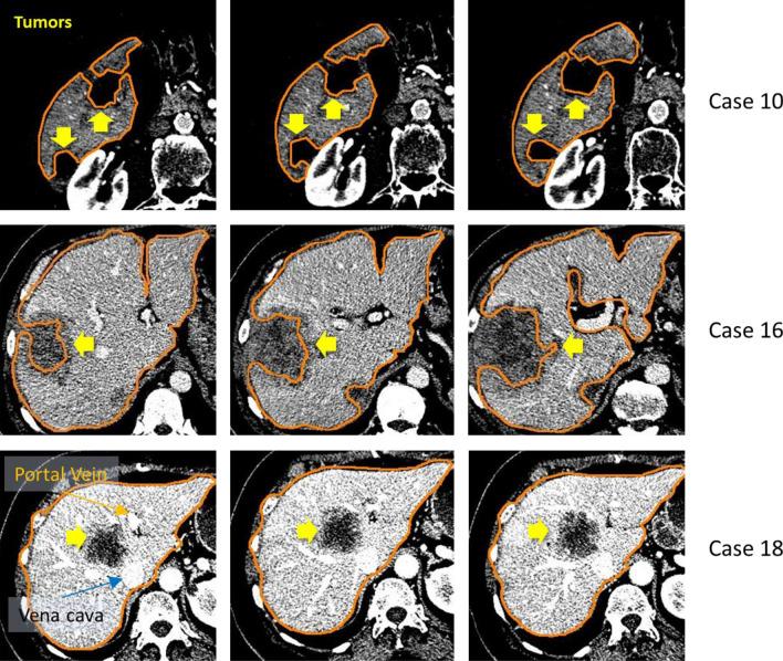 https://cdn.ncbi.nlm.nih.gov/pmc/blobs/1aea/7969941/3678b8350a5f/41598_2021_85436_Fig15_HTML.jpg