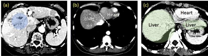 https://cdn.ncbi.nlm.nih.gov/pmc/blobs/1aea/7969941/78dbb8660eec/41598_2021_85436_Fig1_HTML.jpg
