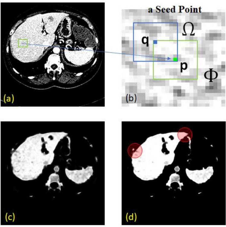 https://cdn.ncbi.nlm.nih.gov/pmc/blobs/1aea/7969941/7da22b0786b9/41598_2021_85436_Fig3_HTML.jpg