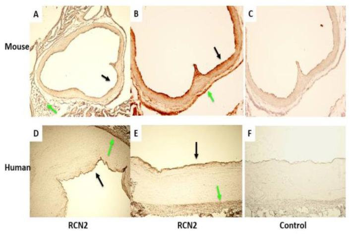 https://cdn.ncbi.nlm.nih.gov/pmc/blobs/1aea/8997427/89bef042ae5a/cells-11-01107-g001.jpg