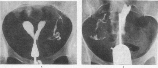 https://cdn.ncbi.nlm.nih.gov/pmc/blobs/1aeb/1871647/9b465c818ab8/procrsmed00250-0054-a.jpg