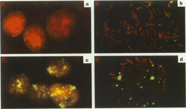 https://cdn.ncbi.nlm.nih.gov/pmc/blobs/1aee/2033297/85184a185e19/brjcancer00053-0088-a.jpg